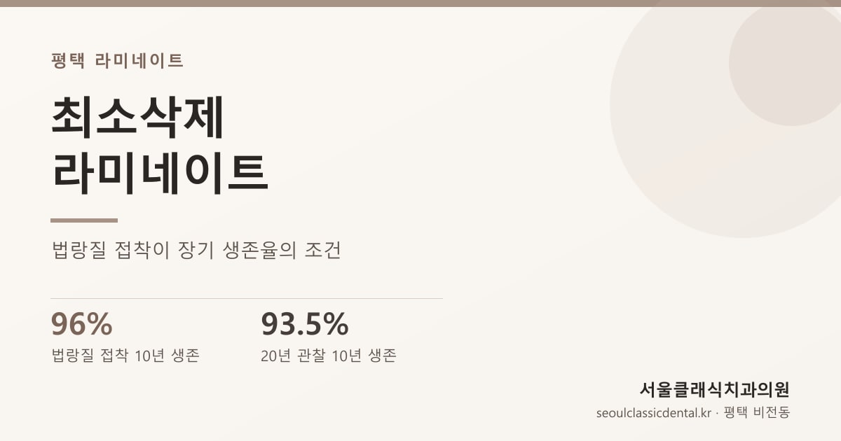 평택 라미네이트 — 최소삭제 라미네이트의 치아 보존 원칙과 장기 생존율